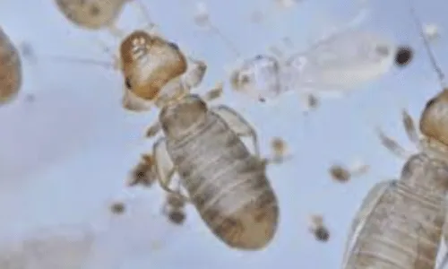 Primo piano su una specie di psocottero visto al microscopio
