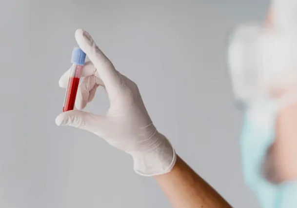 Una provetta d sangue tenuta in mano da un medico